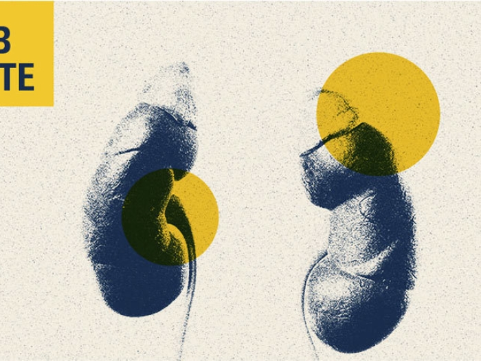 kidneys lab note