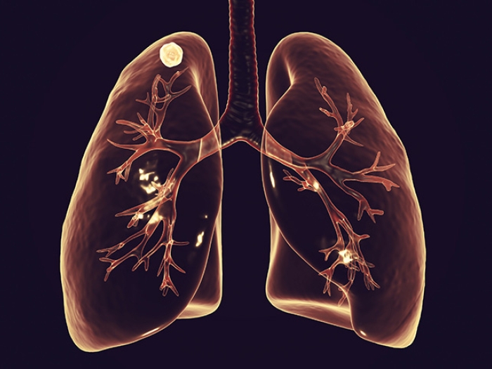 lungs 3d model