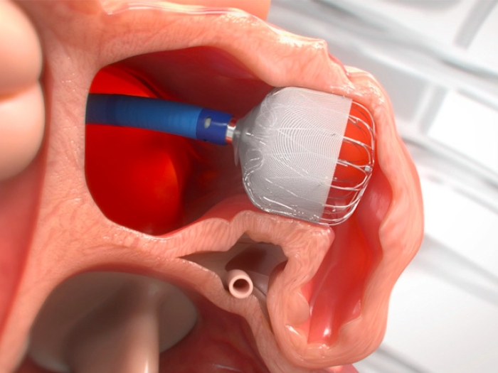 Medical Device 3D Render Heart