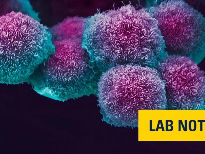 purple and blue microscopic cancer cells with lab note badge on bottom right in yellow and navy