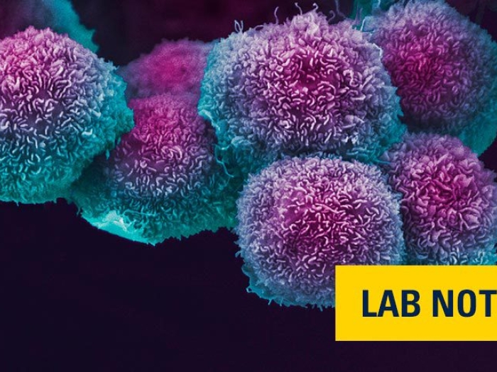 purple and blue microscopic cancer cells with lab note badge on bottom right in yellow and navy