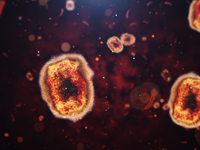 monkey pox virus cells microscopic orange cells