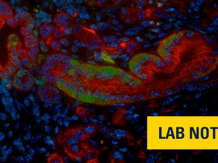 mutlicolored cells merging microscopic blue image with lab note badge in yellow on right