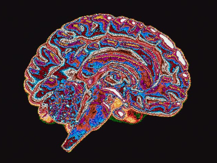 Multicolored rainbow brain cross section on black background