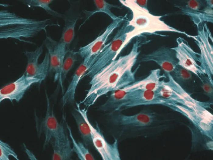 Muscle fiber microscopic scleroderma fibrosis