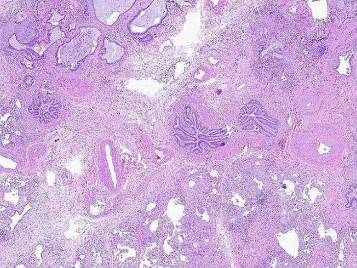 pink purple cellular microscopic slide