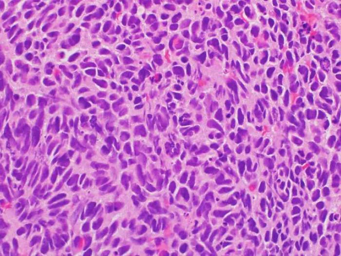pink purple spongy tissue under microscope view