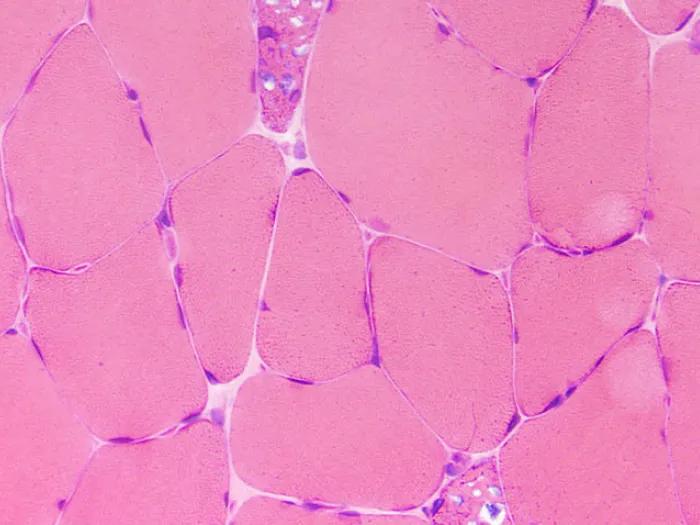 Pink Glycogen under microscope