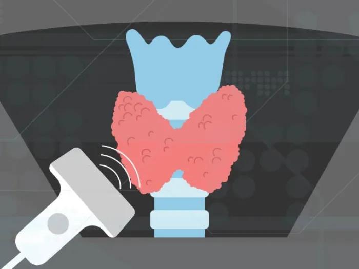 Graphic of Thyroid