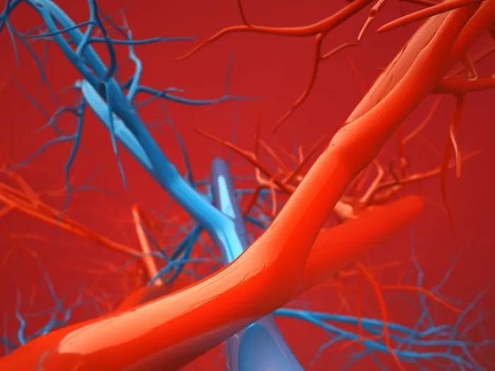 The simulated blood vessels of a jugular vein aneurysm