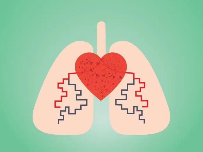 Graphic of a heart and lungs with pulmonary hypertension