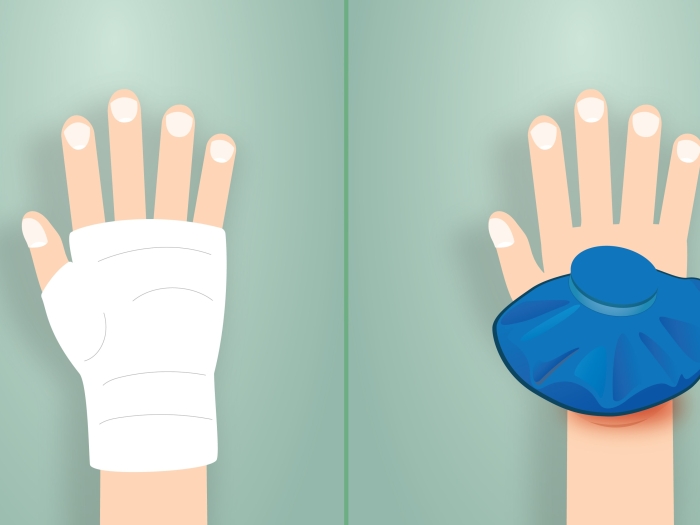 Two different hand injuries requiring acute care