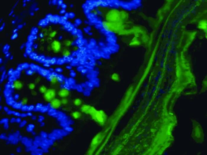 Microscopic image of gut bacteria eating the colon lining