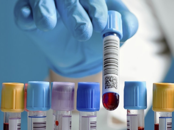 Blood tests for inherited thrombophilia