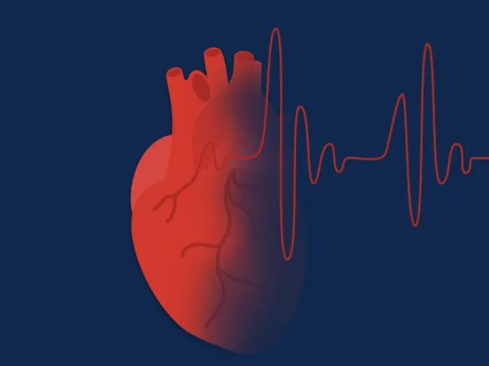 Graphic of a heart with atrial fibrillation