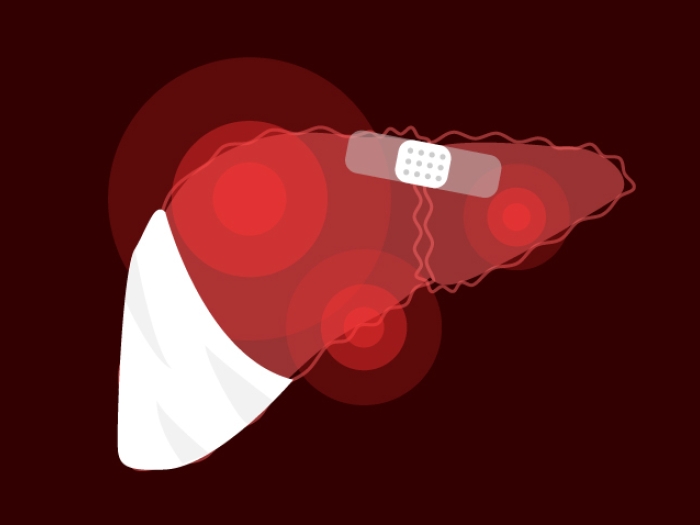 liver with injuries