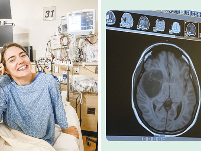 woman sitting on hospital bed smiling in blue gown and brain scan on right with tumor in it