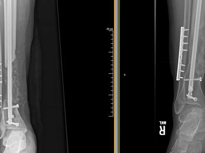 x-ray image