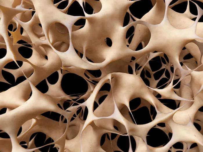 Bone mesh