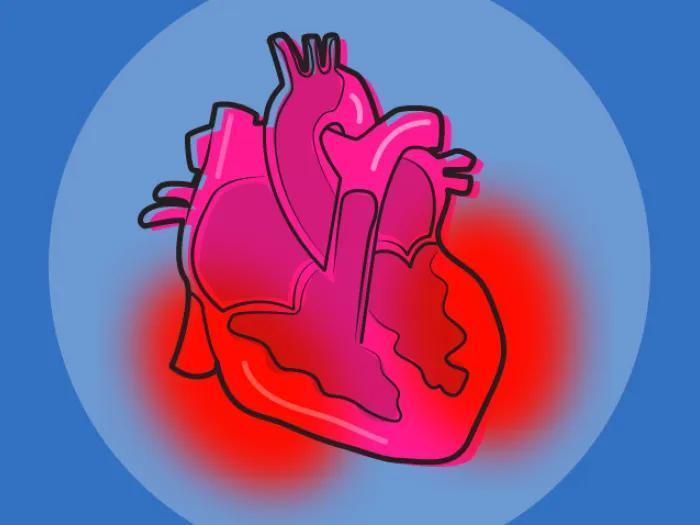 cardiovascular heart inflammation pink red blue background