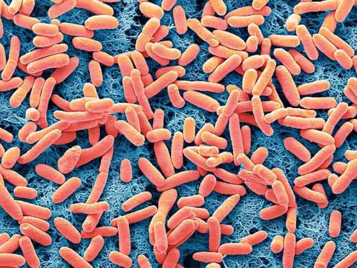 Close up of ecoli bacteria