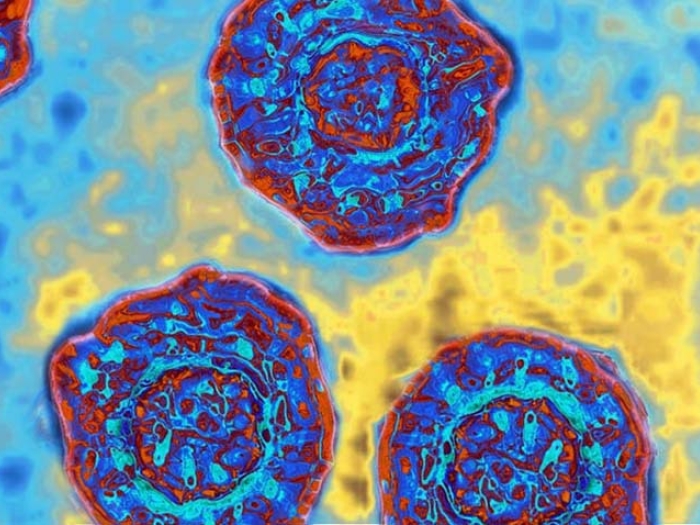 image of purple and blue cells on a blue background with some yellow in background