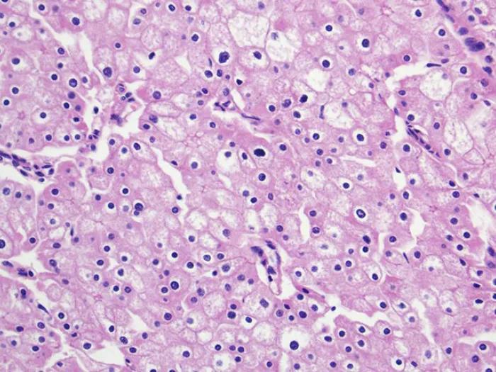 Kidney cells strained