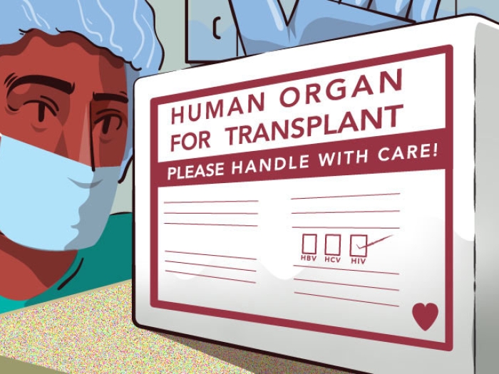 Organ chronic disease hiv tranplant donation