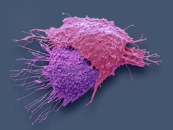 Ovarian Cancer Cells