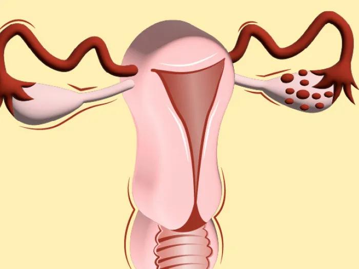 ovaries and fallopian pink red and yellow background