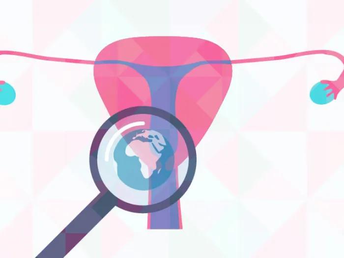 Preventing cervical cancer globally