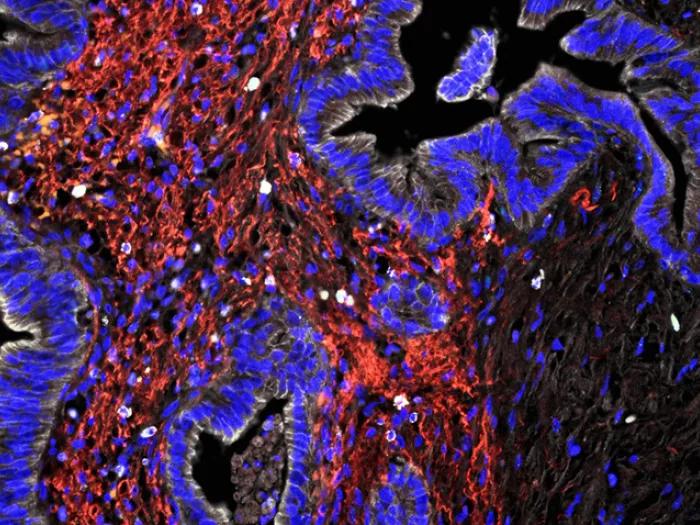 purple black red cell image close up