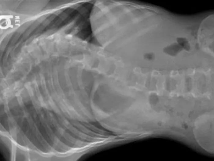 x-ray image