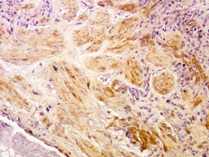 Stifflung image