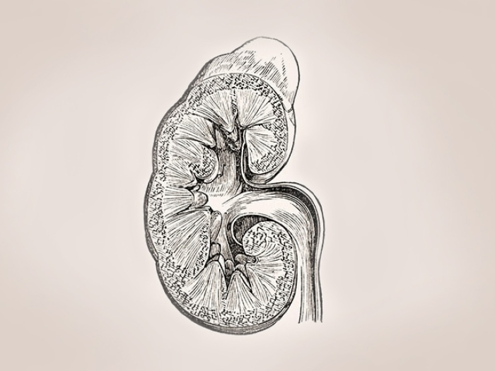 Illustration of a a kidney with lupus nephritis
