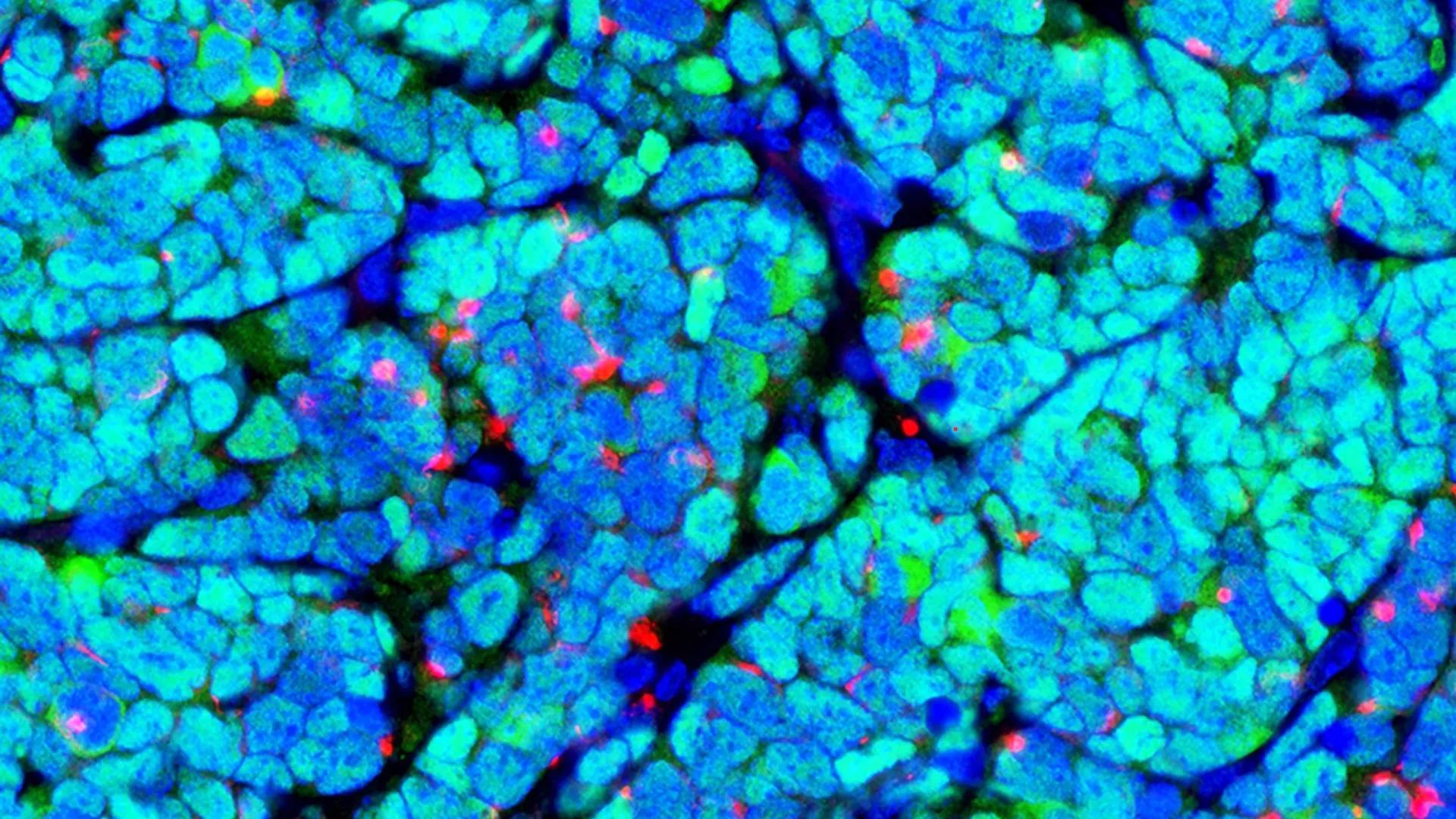 Cells in blue, green, pink, and teal