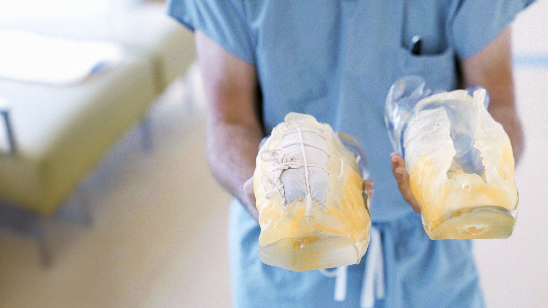 Person in scrubs holding 2 3D printed models of chest and abdomen structures of conjoined twins.
