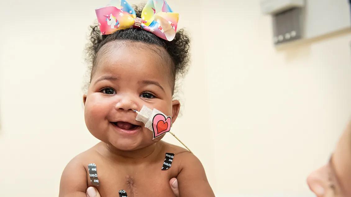 Baby who has had heart surgery