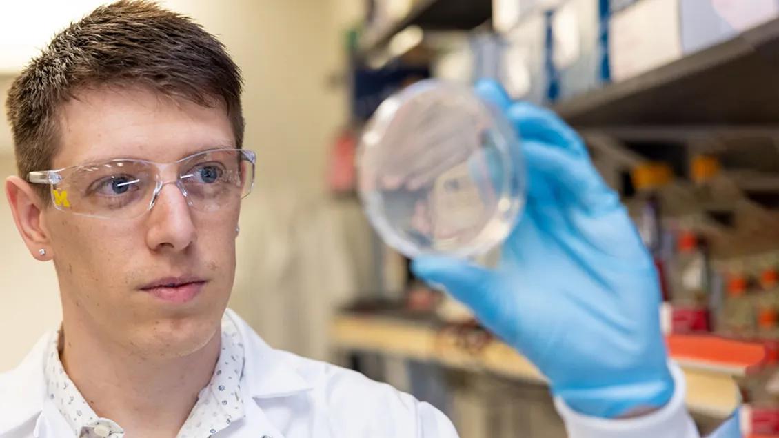 A post-doctoral student with short brown hair wearing a white jacket and blue gloves holds up a petri dish.