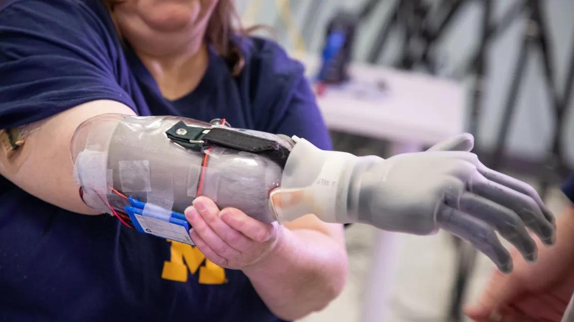 A patient tests a prosthetic right arm.