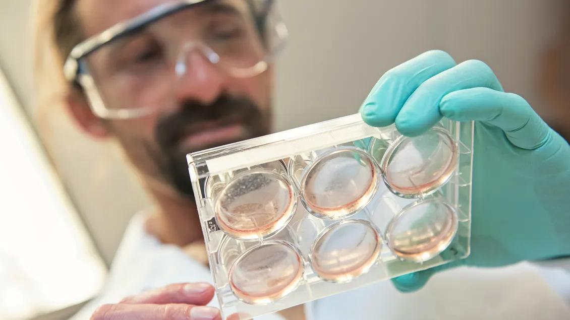 Costas Lyssiotis, Ph.D., closely examines a cell culture plate.