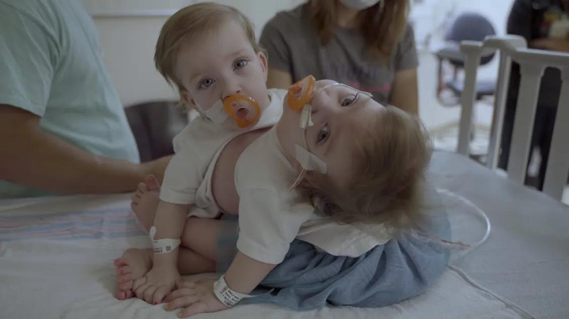 Conjoined twins sitting in baby crib