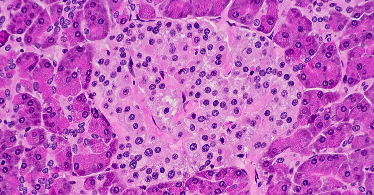 Ucreatic Cell Study links gene network and pancreatic beta cell defects to type 2 ...