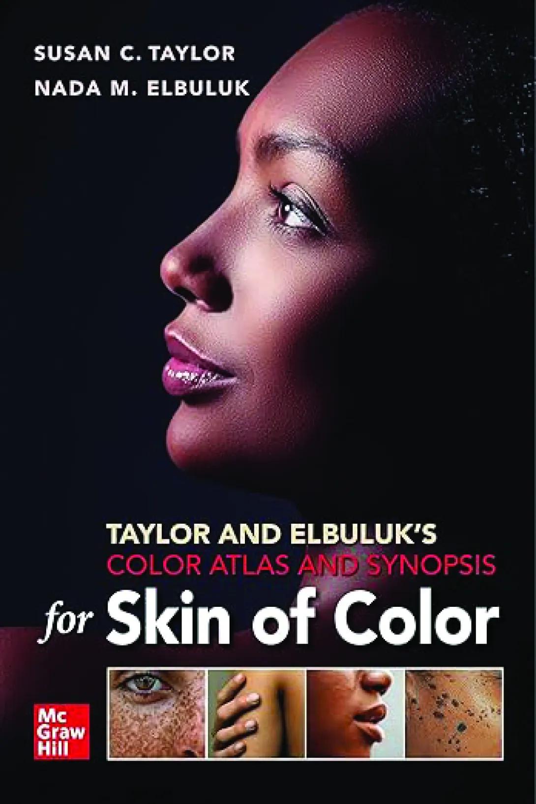Book cover of "Color Atlas and Synopsis for Skin of Color" featuring a Black woman's face. There are four images at the bottom that are close ups of a Black person's skin.  